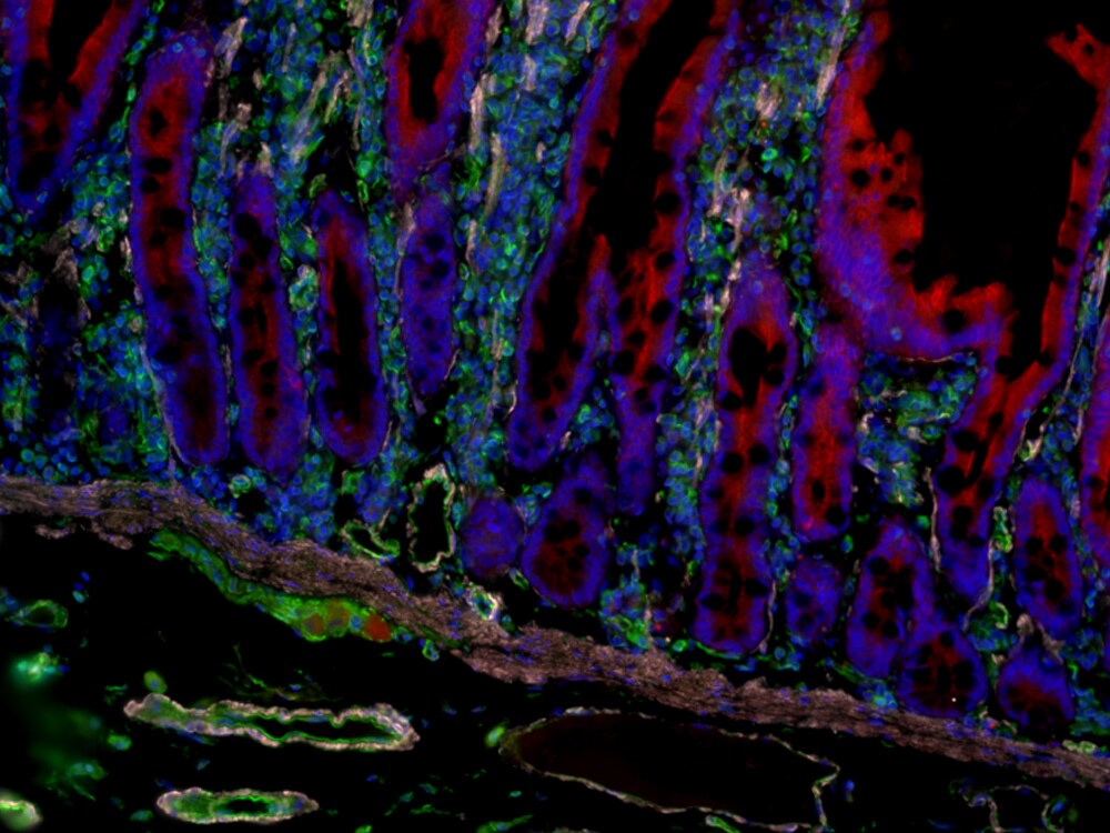 prolong rapidset antifade FFPE human intestine fluorescently labeled and mounted with prolong rapidset antifade