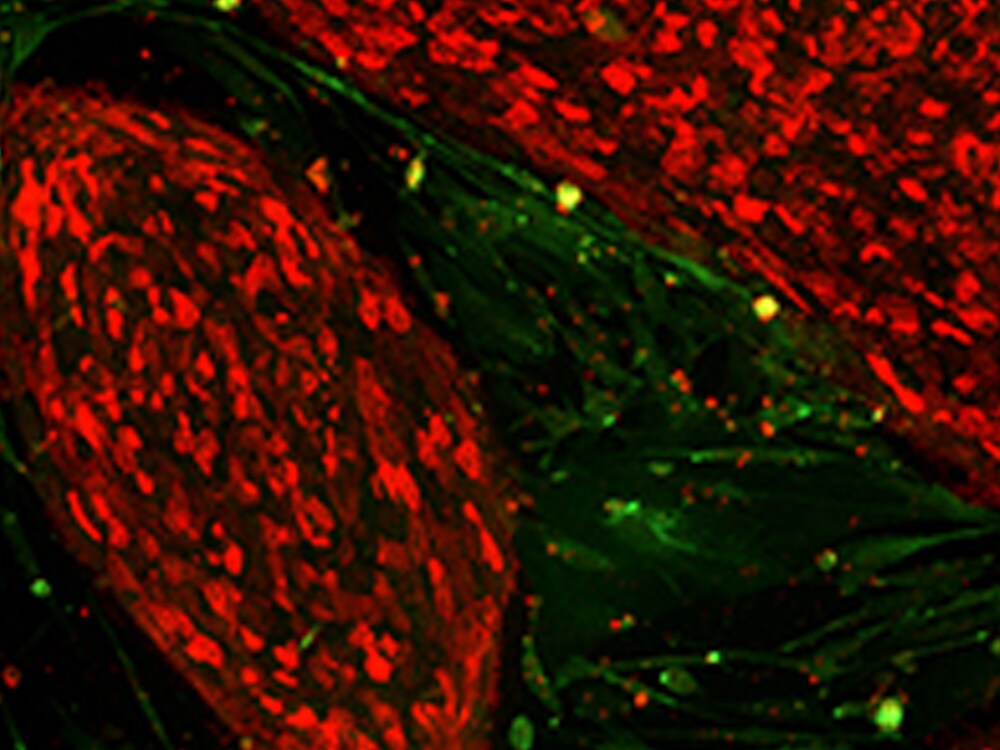 prolong diamond antifade fluorescent pluripotent stem cells mounted with prolong diamond antifade