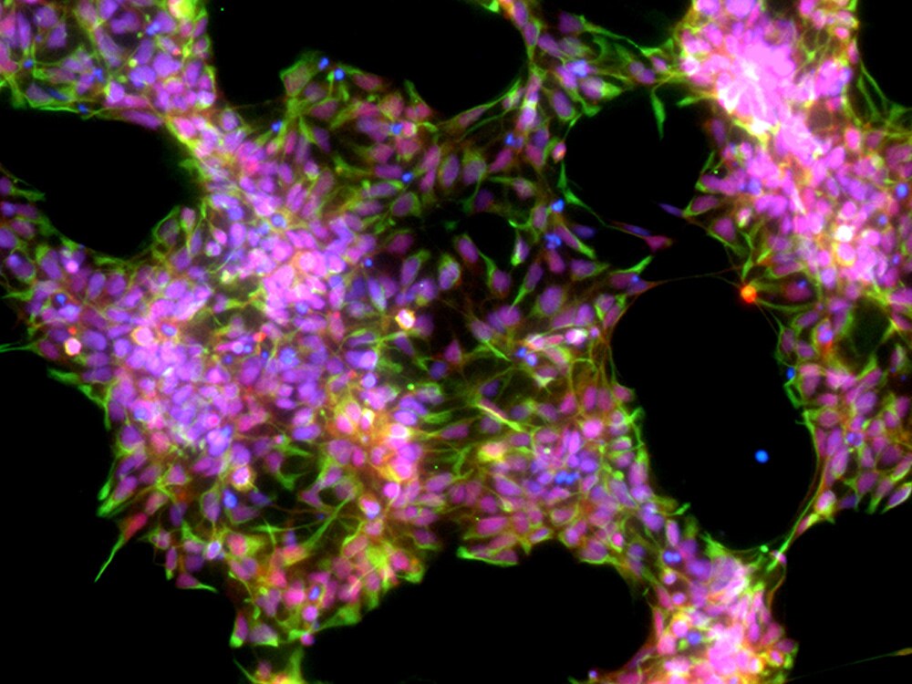 prolong diamond antifade fluorescent neuronal stem cells mounted with prolong diamond antifade