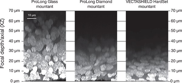 不同抗荧光淬灭封片剂的性能 不同抗荧光淬灭封片剂性能