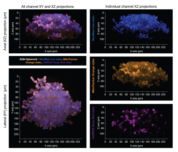 使用ProLong Glass 抗淬灭封片剂封固的A549 球状体的纵向和横向共聚焦图像。 使用ProLong Glass 抗淬灭封片剂封固的A549 球状体的纵向和横向共聚焦图像。