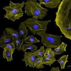 HeLa cells imaged using the CellInsight CX5 platform HeLa cells imaged using the CellInsight CX5 platform