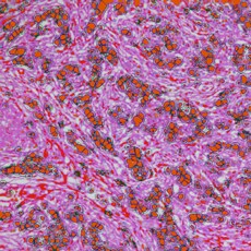 White light brightfield image of a fixed tissue slice imaged with the CellInsight CX5 platform. White light brightfield image of a fixed tissue slice imaged with the CellInsight CX5 platform.