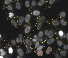 hcs-apoptosis-caspase-assay-banner hcs-apoptosis-caspase-assay-banner