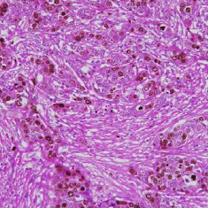 Three-color brightfield image of a fixed tissue slice imaged with the CellInsight CX7 platform. Three-color brightfield image of a fixed tissue slice imaged with the CellInsight CX7 platform.