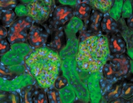 IHC-image-270x210 IHC-image-270x210