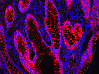 免疫组化-IHC-免疫组织化学技术-赛默飞 | Thermo Fisher Scientific - CN