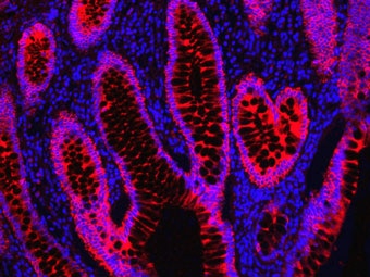 000006-IHC-cytokeratin-DyLight-594-streptavidin-340px 000006-IHC-cytokeratin-DyLight-594-streptavidin-340px