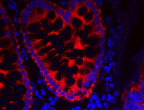 免疫组织化学概览 免疫组织化学概览