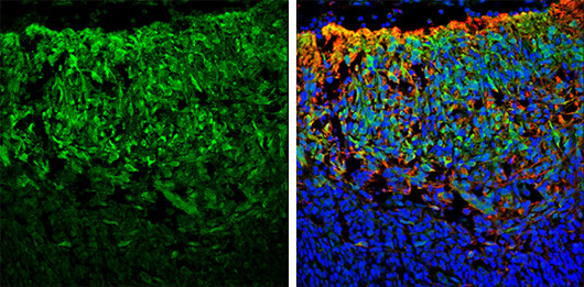 免疫组化-IHC-免疫组织化学技术-赛默飞 | Thermo Fisher Scientific - CN
