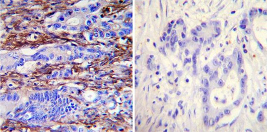 免疫组化-IHC-免疫组织化学技术-赛默飞 | Thermo Fisher Scientific - CN