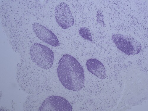 使用 SuperBoost EverBlue 的 FFPE 用 Ki-67 抗体/超级促进剂 Everblue 染色的人类扁桃体