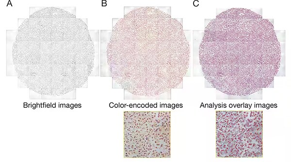 免疫组化染色组织芯片的 HCA 分析 经不同处理的一抗、二抗和抗原染色的组织切片阵列的明视野图像