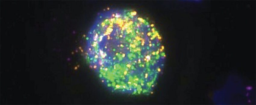 使用 ViewRNA ISH 细胞检测法鉴定乳腺癌 CTC 使用 ViewRNA ISH 细胞检测法鉴定乳腺癌 CTC