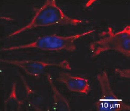 使用 ViewRNA ISH 细胞检测法可视化和量化细胞系中的转录本异质性 使用 ViewRNA ISH 细胞检测法可视化和量化细胞系中的转录本异质性