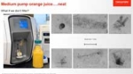 High-speed, clog-resistant spectral flow cytometry video thumbnail