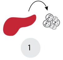 分离肿瘤样品 分离肿瘤样品