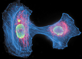 multicolor stained cell skin fibroblast cells labeled for histone antibody (green), actin (blue), and mitochondria (red)
