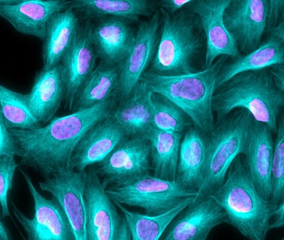 multicolor image of cells cells labeled with tubulin (cyan) and nuclei (magenta)