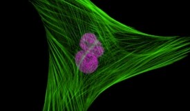 multicolor stained cell Fibroblast cell with green cytoskeleton and pink nucleus