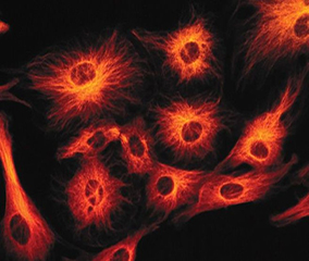Fluorescent image of neurons Neurons labeled with anti-human neuronal protein (red-orange)