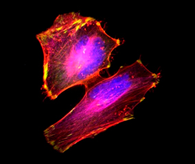 multicolor stained cell hela cells with labeled actin (orange/pink) and nucleus (blue/purple)