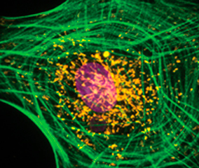 multicolor stained cell skin fibroblast cell with labeled mitochondria (orange), actin (green), and nucleus (pseudocolored magenta)