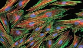 Skin fibroblasts stained with Alexa Fluor Phalloidin and Zenon Mouse Labeling Kit Microscopic view of skin fibroblasts with F-actin (green), alpha-tubulin (orange) and cdc-6 peptide (blue)