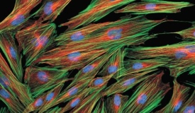 Skin fibroblasts stained with Alexa Fluor Phalloidin and Zenon Mouse Labeling Kit Microscopic view of skin fibroblasts with F-actin (green), alpha-tubulin (orange) and cdc-6 peptide (blue)