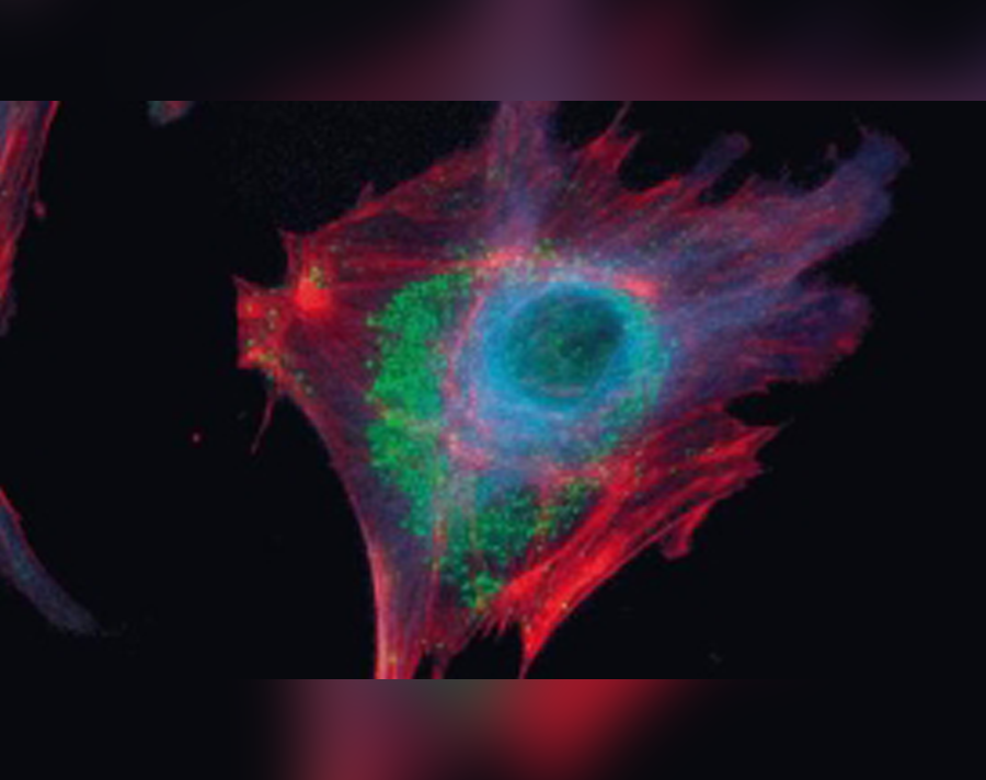 Stained bovine pulmonary artery endothelial cells Microscopic view of bovine endothelial cells with F-actin (orange), alpha-tubulin (blue) and endosomal pathway components (green)