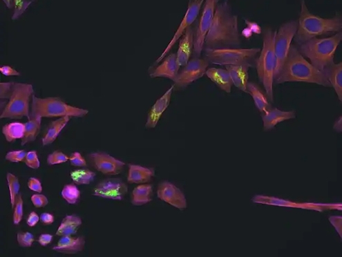multicolor microscopy image overlay of cells stained with green tubulin, red actin, blue nuclei