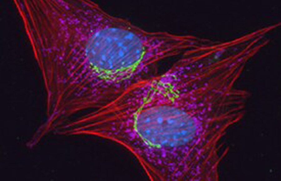 Stained NIH 3T3 mouse fibroblasts Microscopic view of mouse fibroblasts with golgi, mitochondria and nuclei
