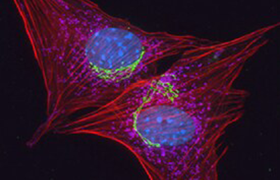 Stained NIH 3T3 mouse fibroblasts Microscopic view of mouse fibroblasts with golgi, mitochondria and nuclei