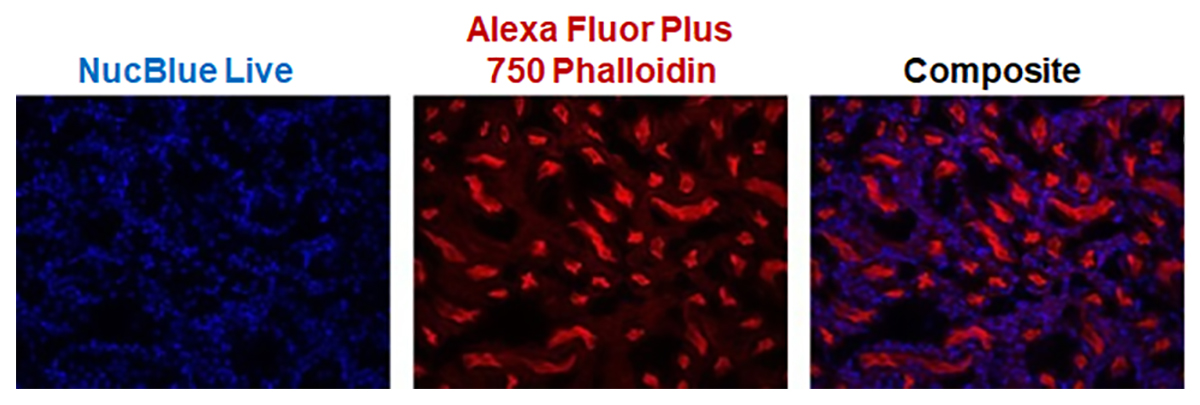 stained mouse kidney tissues 3 microscopic images of mouse kidney tissues, left is labeled with Hoechst stain (blue), middle with Alexa Fluor 750 Phalloidin (red) and right is composite image