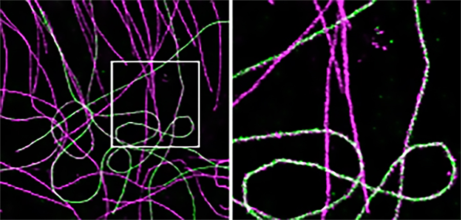 stained microtubules Microscopic view of 2 colored tubulin stained with Alexa Fluor 750 dye (green) and Alexa Fluor 647 dye (magenta)