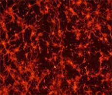 Neuronal-Cell-Health-Assays Neuronal-Cell-Health-Assays