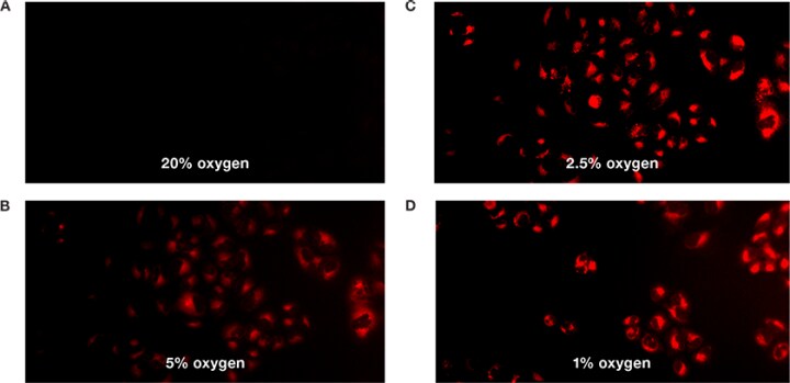 缺氧条件的检测 缺氧条件的检测