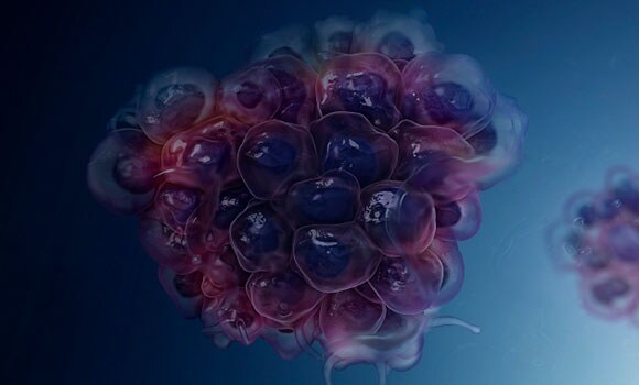 A cancer cell cluster An illustrated purple cancer cell cluster on a dark blue background