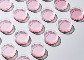 We offer cell culture dishes in wide selections of format, material, and surface modification thermo scientific cell culture tissue culture dishes