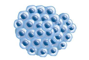 Cancer spheroid cancer spheroid illustration