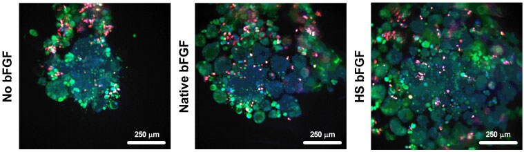 Brightfield microscopy image of cancer spheroids grown with Gibco HS bFGF Brightfield microscopy image of cancer spheroids grown with Gibco HS bFGF