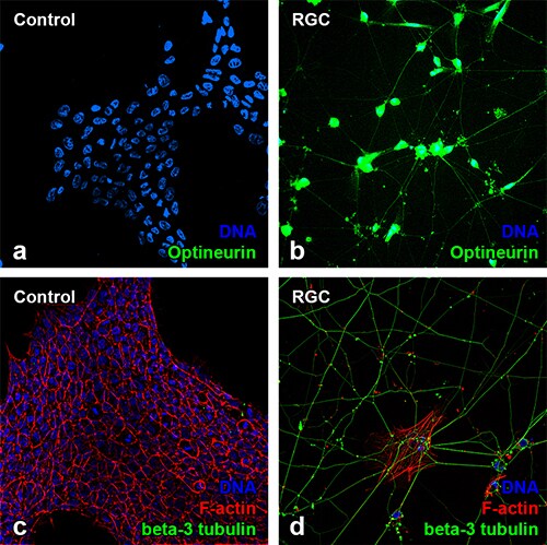 图像标题:Gibco 人非整合性 iPSC 通过使用 IGF1R 重组人蛋白激活胰岛素样生长因子 (IGF) 信号传导分化成视网膜神经节细胞 使用 Gibco 和 Invitrogen 重组蛋白进行神经生物学研究的 iPSC 到视网膜神经节细胞 (RGC) 的荧光细胞图像