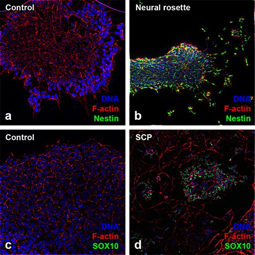 图像标题:Gibco 人游离型 iPSC 在用 TGF-β 抑制剂、GSK-3 抑制剂和 神经调节蛋白-1 处理后分化为许旺氏细胞祖细胞 使用 Gibco 和 Invitrogen 重组蛋白进行神经生物学研究的 iPSC 到神经玫瑰花环/许旺氏细胞祖细胞的荧光细胞图像