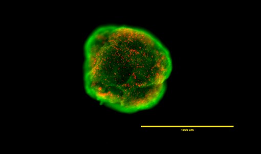 Human ESC in embryoid body on Nunclon Sphera surface Microscopic view of viability of embryoid body cultured on Nunclon Sphera surface