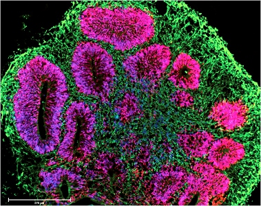 Brain organoid cultured on Nunclon Sphera surface Microscopic view of brain organoid cultured on Nunclon Sphera surface