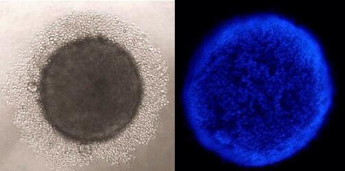 Neurospheres growing on Nunclon Sphera surface Microscopic views of neurospheres growing on Nunclon Sphera surface