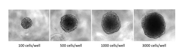 HCT 116 3D tumor spheroids at different seeding densities on Nunclon Sphera surface Microscopic views of HCT 116 3D tumor spheroids at different seeding densities on Nunclon Sphera surface