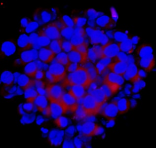 HeLa 3D tumor spheroid on Nunclon Sphera surface Microscopic view of hypoxic core of HeLa 3D tumor spheroid cultured on Nunclon Sphera surface