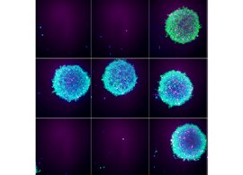 3D cell culture plates, dishes, flasks 3D tumor spheroids on Nunclon Sphera 3D cell culture plates