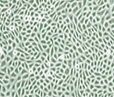 角质形成细胞培养系统 角质形成细胞培养系统